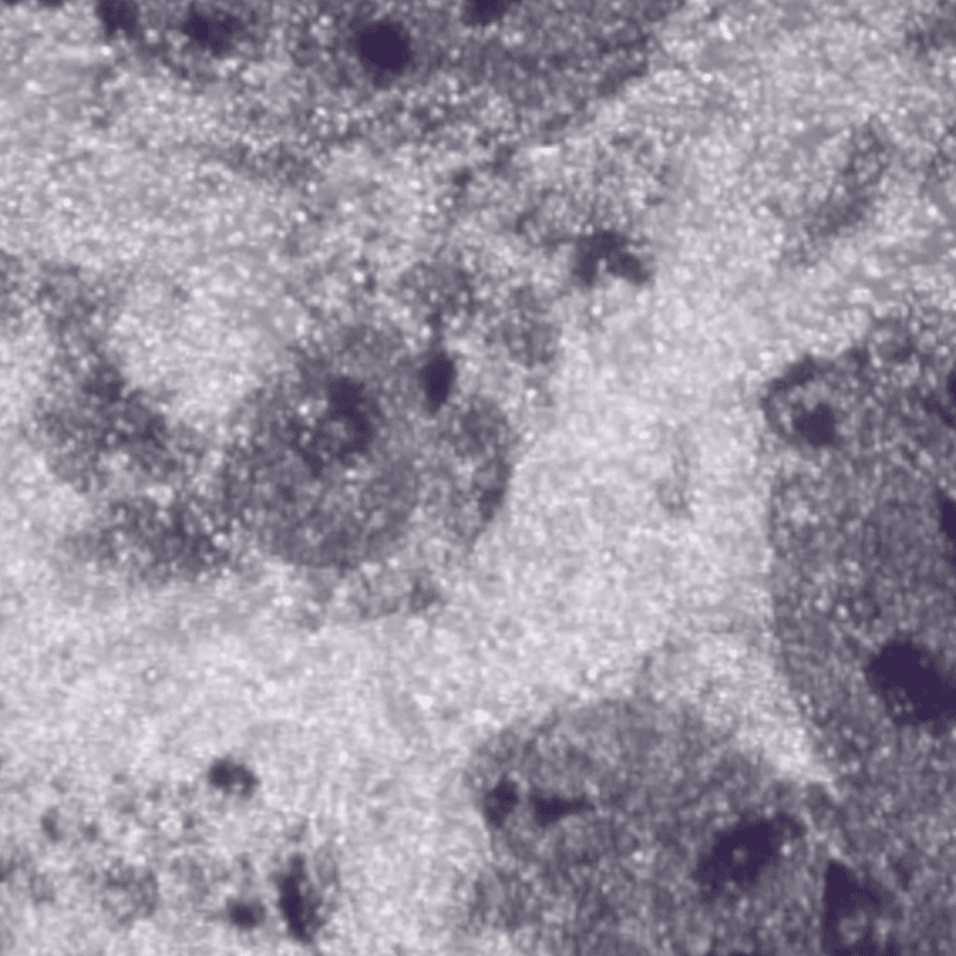 På den anden side – Biennale 2020